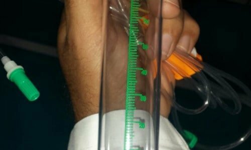LINHA COMPLETA DE FABRICAÇÃO DE CONTA GOTAS FARMACEUTICA