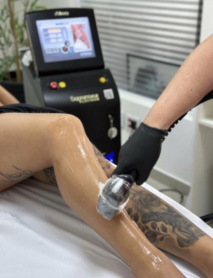 Venda de clínica de bronzeamento e depilação a laser
