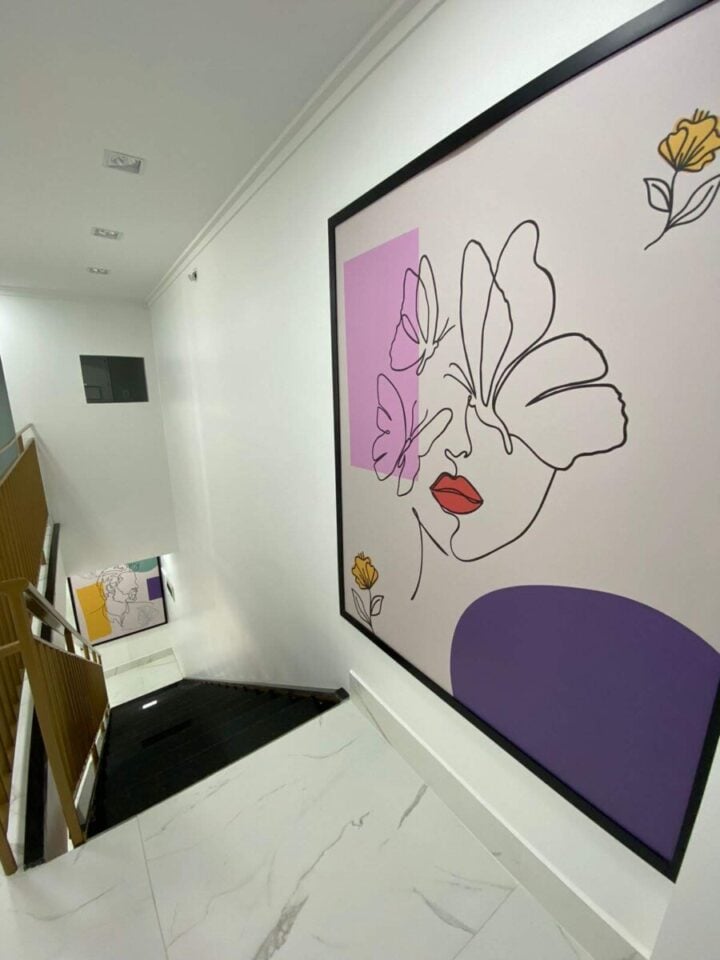 Harmonização Facial Avançada