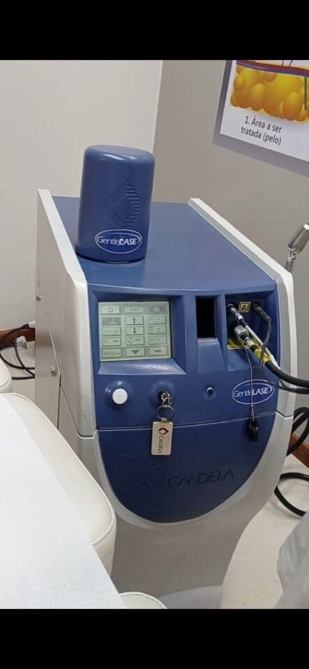 Locadora Equipamentos Estética a Laser de Ultima Geração