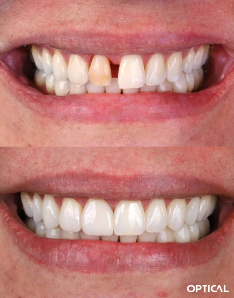 Optical Dental Clinic – Dentista em Salvador, Clínica Odontológica Descub